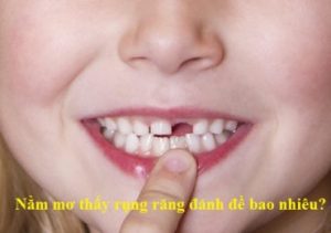 Nằm mơ thấy rụng răng đánh đề bao nhiêu?